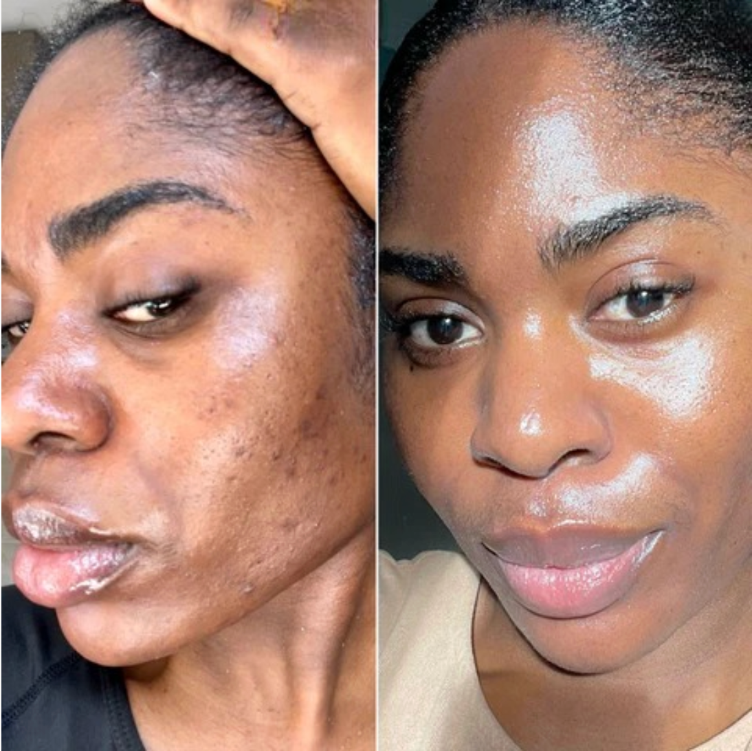 Jelly Cream for Black Skin