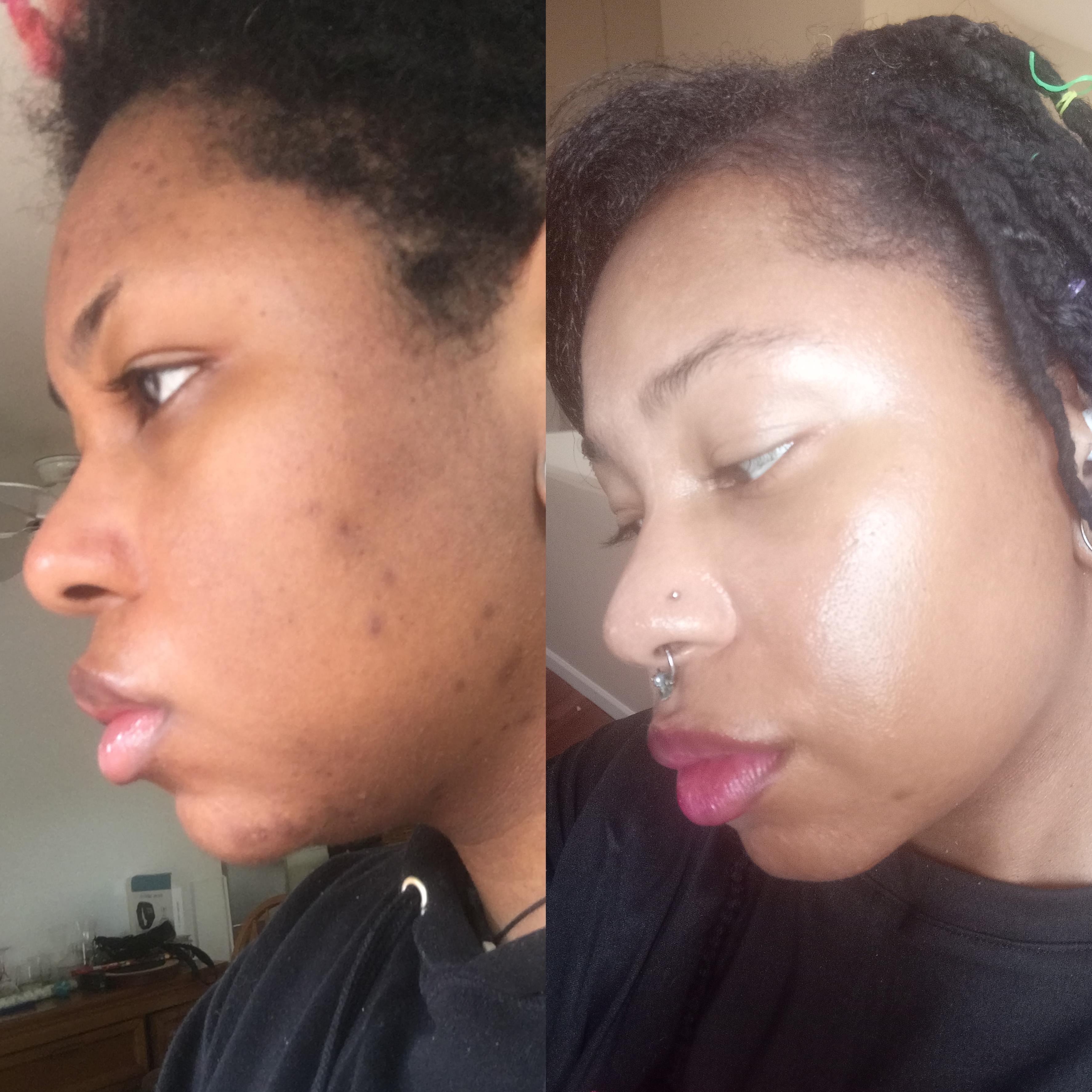 Jelly Cream for Black Skin