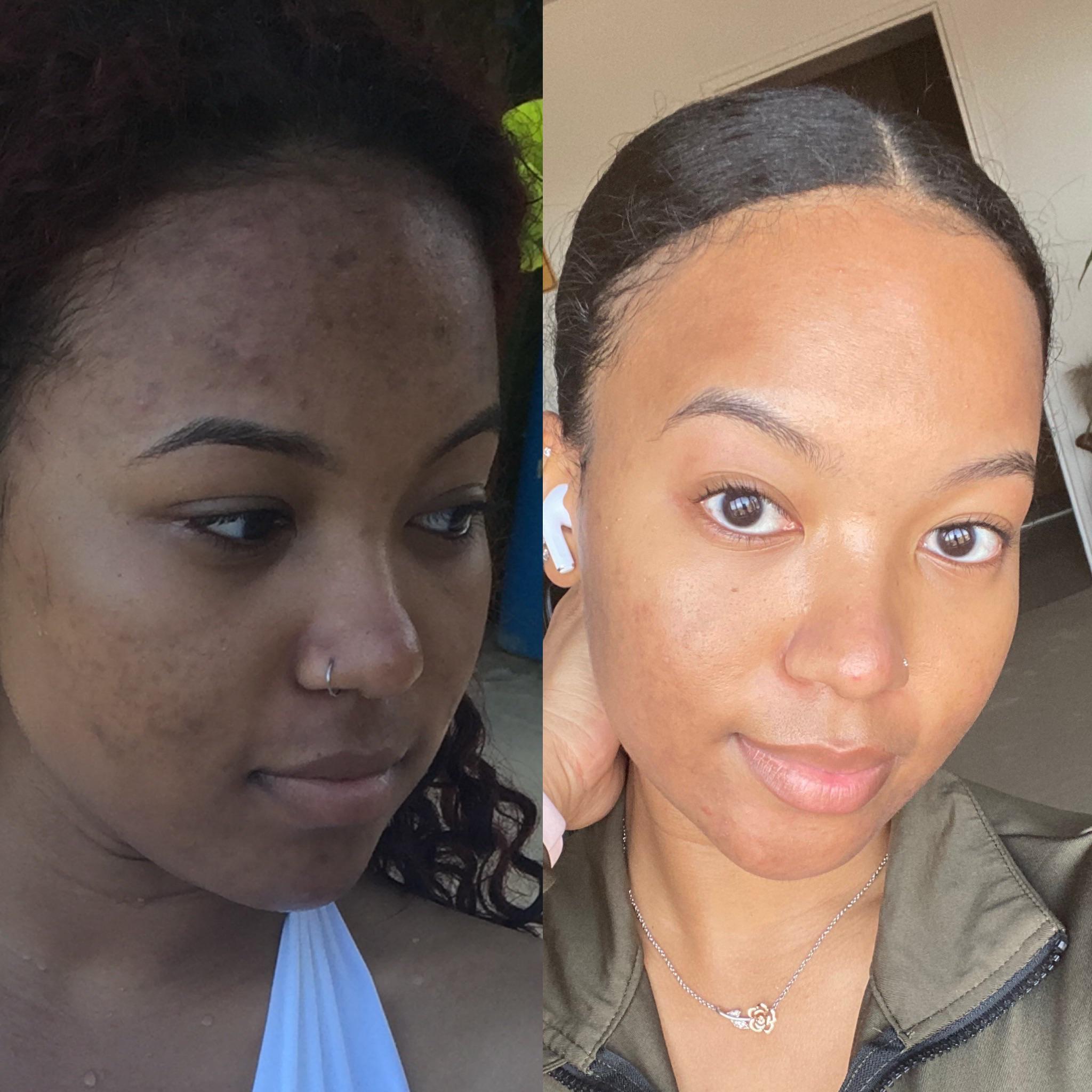 Jelly Cream for Black Skin