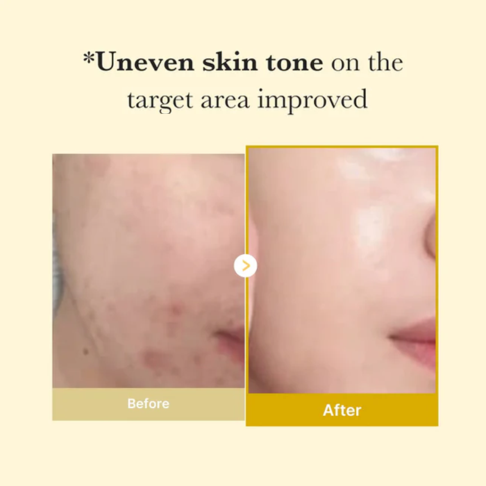 Kojic Acid Turmeric Night Wrapping Mask